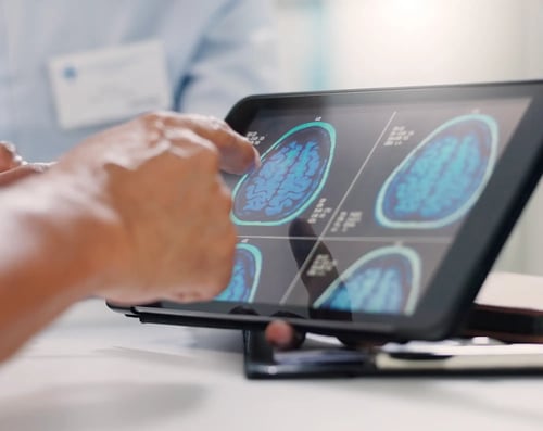 Implementing a Real-Time Visual Monitoring System...